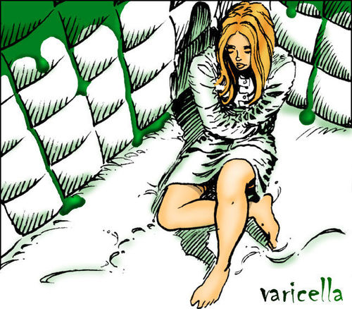 Cover for Varicella.